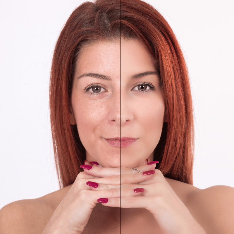 anti age behandlungen (1) Anti-Aging Behandlung Kosmetikstudio